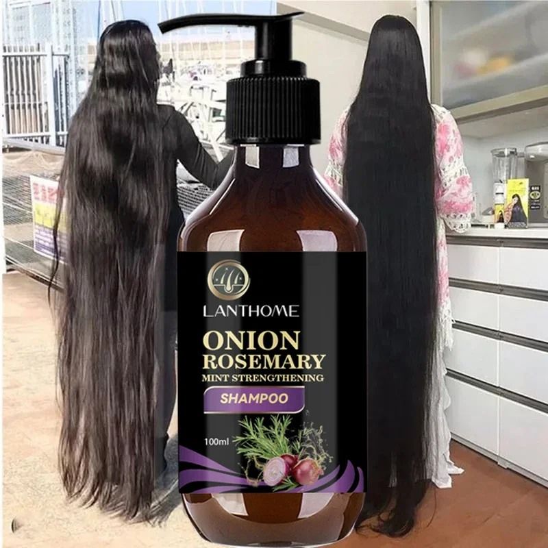 Rosemary Onion Hair Growth Shampoo with Anti-Hair Loss Spray – Fast Hair Regrowth in 7 Days