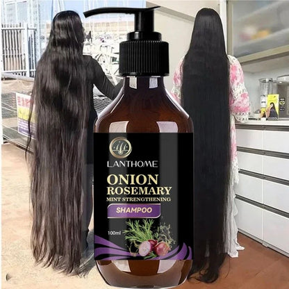 Rosemary Onion Hair Growth Shampoo With AntiHair Loss Spray  Fast Hair Regrowth In 7 Days 1