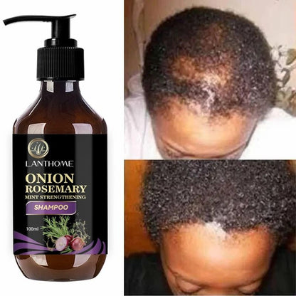 Rosemary Onion Hair Growth Shampoo With AntiHair Loss Spray  Fast Hair Regrowth In 7 Days 3