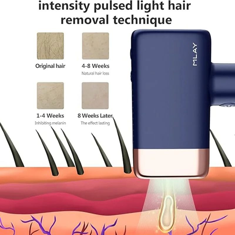 Home IPL Hair Removal Device With Replaceable Lamp For FullBody Use 1