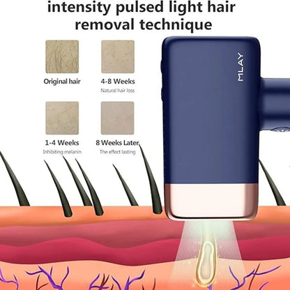 Home IPL Hair Removal Device With Replaceable Lamp For FullBody Use 1