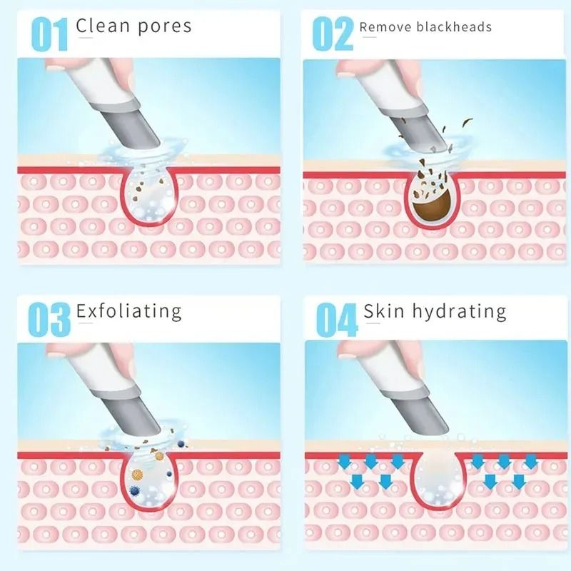 Professional Hydra Dermabrasion Aqua Facial Beauty Device 5