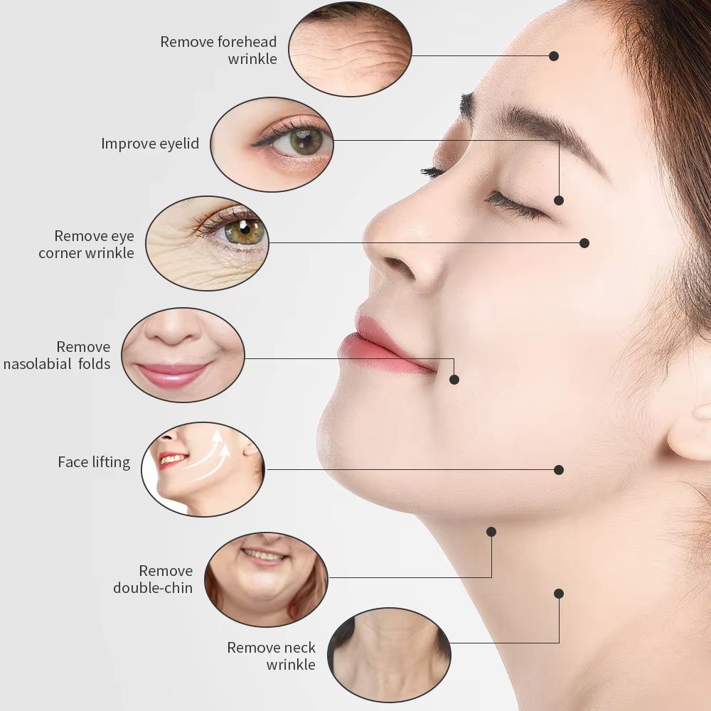 RadianceLift 3in1 RF Skin Tightening  Face Lifting Device 3