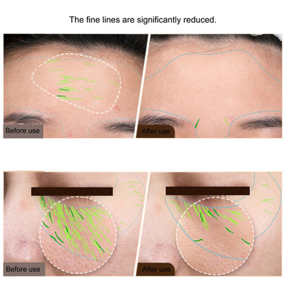 Professional EMS RF Facial And Body Skin Tightening Device  Home Radio Frequency Machine For Face L 1