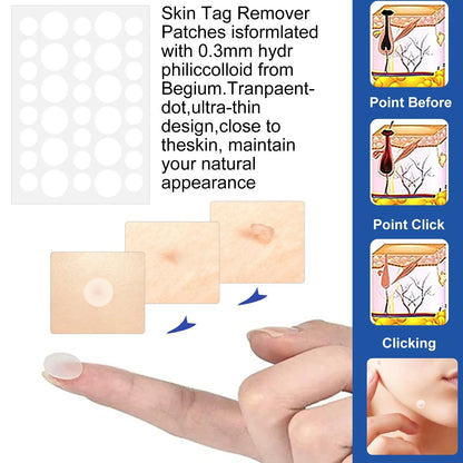 2 In 1 Painless Auto Skin Tag And Mole Remover Kit 2