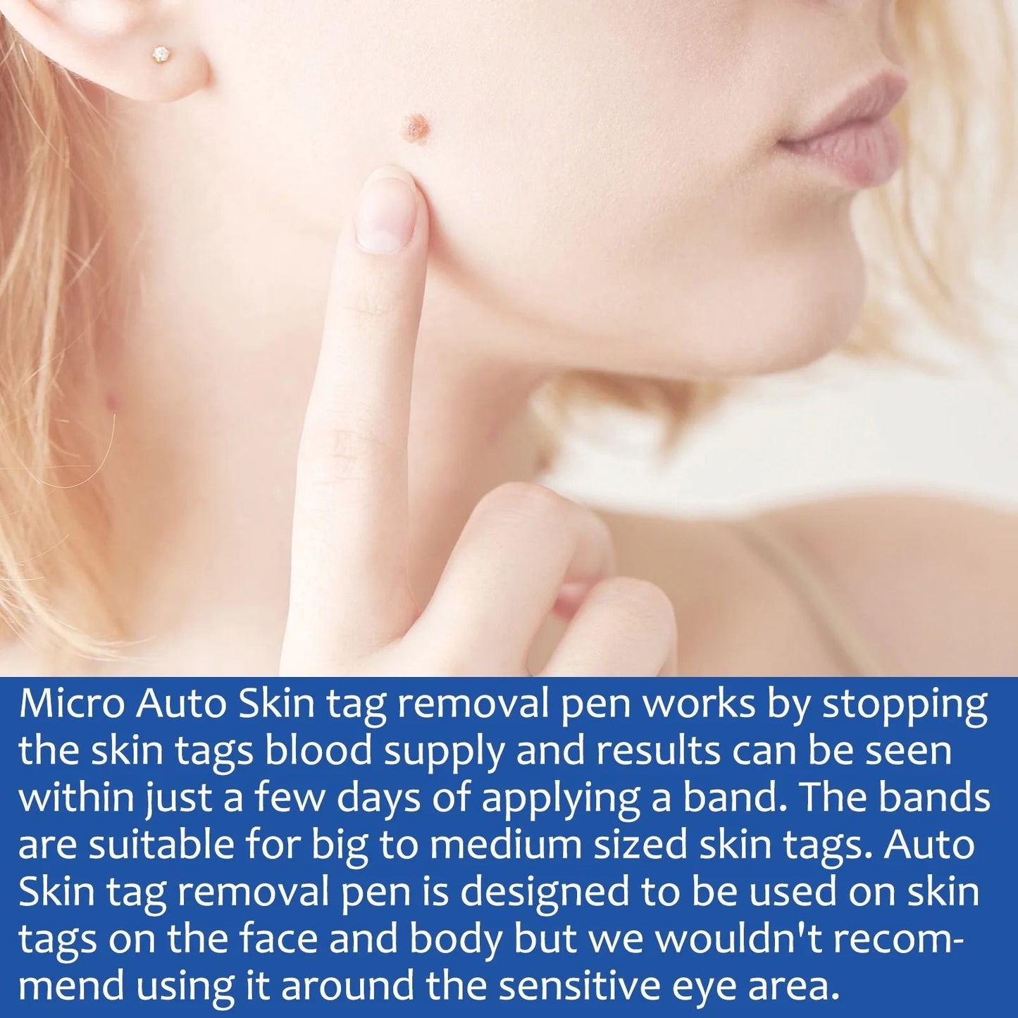 2 In 1 Painless Auto Skin Tag And Mole Remover Kit 3