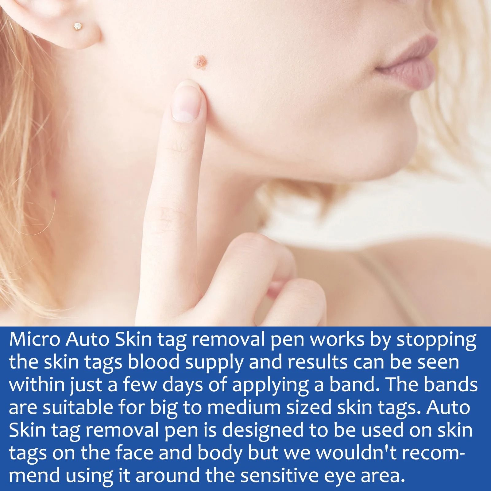 2 In 1 Painless Auto Skin Tag And Mole Remover Kit 3