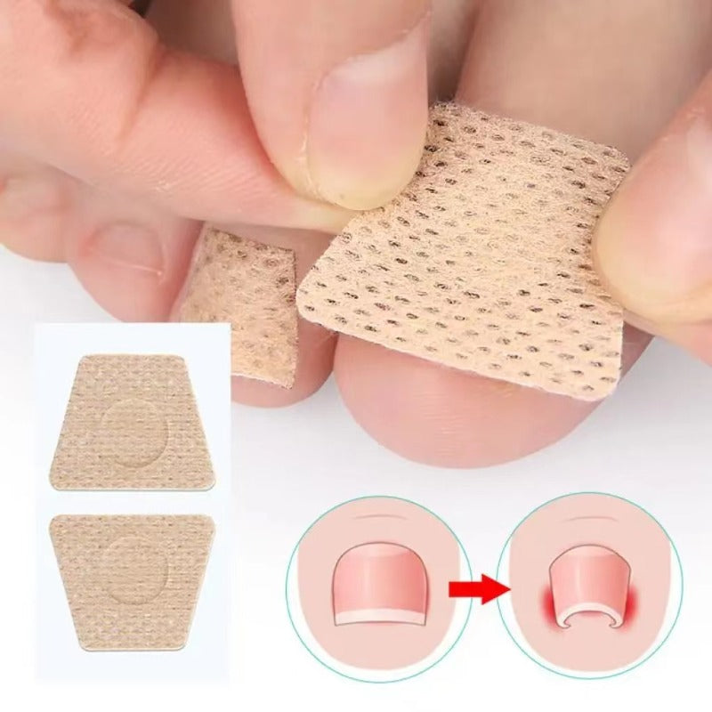 Nail Art Foot Patches Feet Care, Ingrown Toenail Toe Correction Stickers, Paronychia Treatment Recover Pedicure Tool