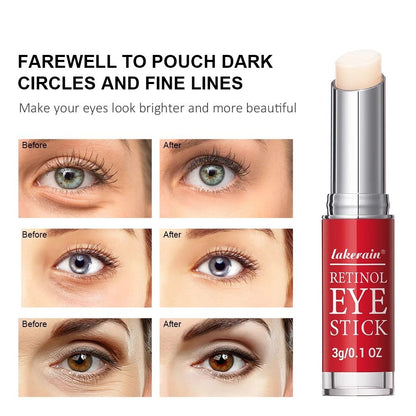 Retinol Eye Cream Stick For Dark Circles And Firming 2