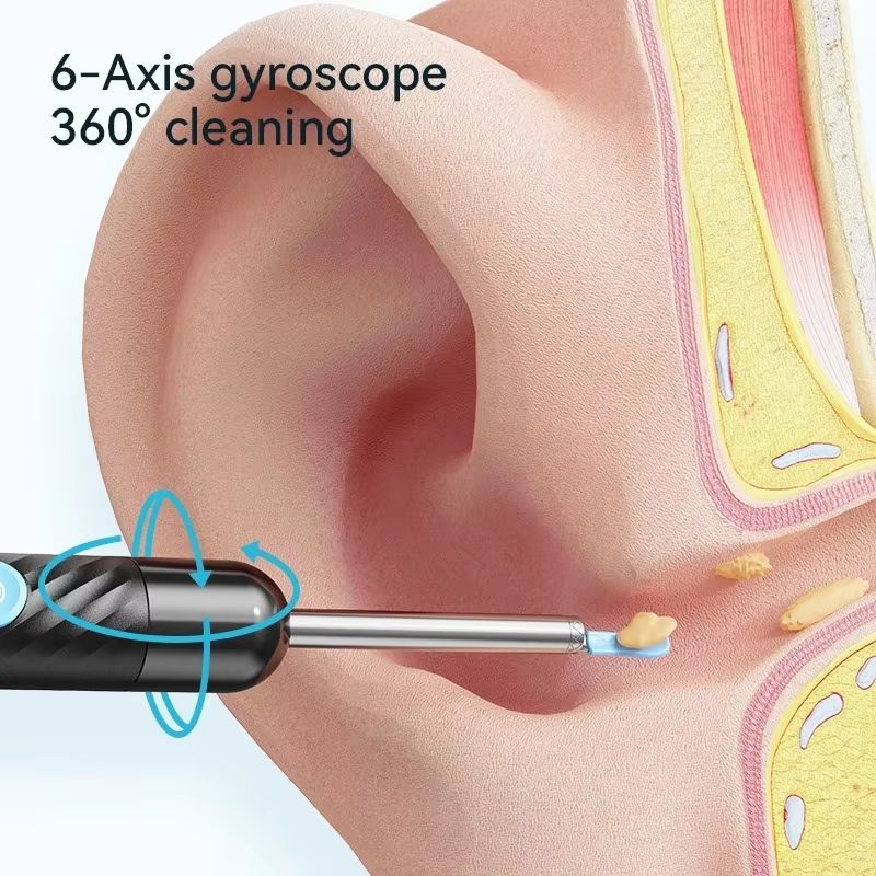 Wireless Ear Cleaner With 8MP Camera  Rechargeable Ear Wax Removal Kit With Ear Spoon 2