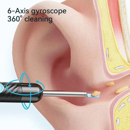 Wireless Ear Cleaner With 8MP Camera  Rechargeable Ear Wax Removal Kit With Ear Spoon 2