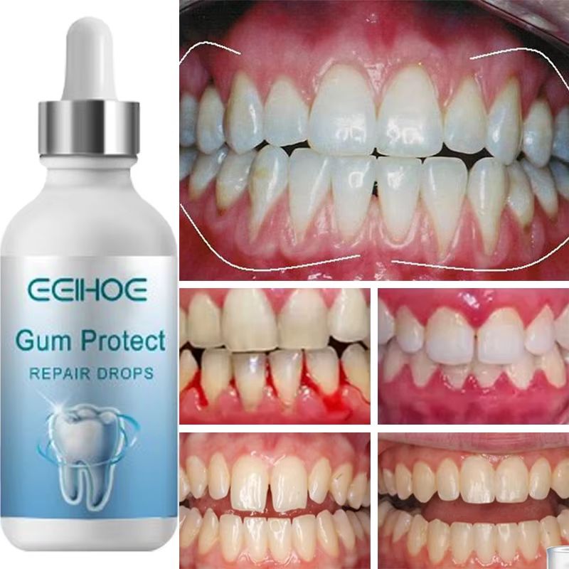 Rapid Repair Gums Serum  Instant Relief For Sensitive Teeth Cavities  Gum Damage 1