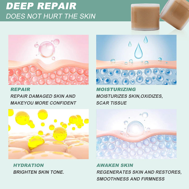 Medical Grade Silicone Scar Sheet Painless Effective Scar Repair Tape Silicone Scar Tape For Surgic 1