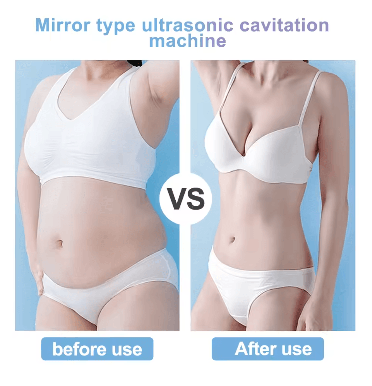 UltraTone 4 In 1 Cavitation Slimming And Skin Tightening Device For Face And Body Care 1