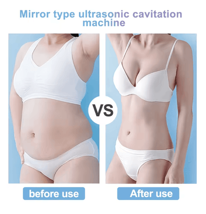 UltraTone 4 In 1 Cavitation Slimming And Skin Tightening Device For Face And Body Care 1