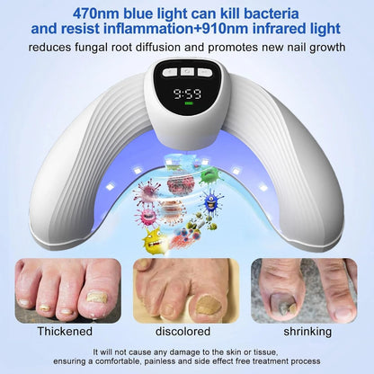Laser Nail Fungus Treatment Device for Healthy Toenails and Fingernails