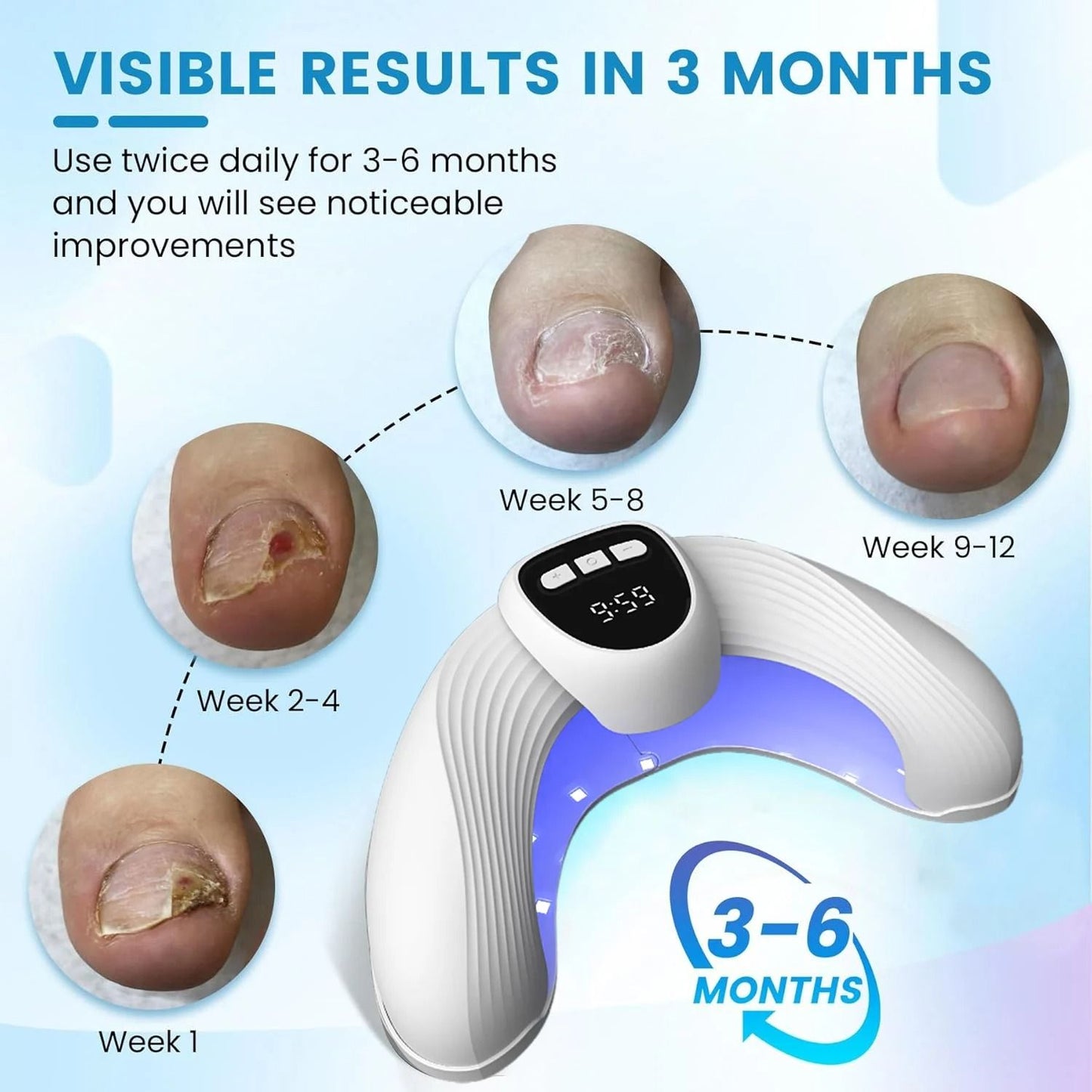 Laser Nail Fungus Treatment Device For Healthy Toenails And Fingernails 2