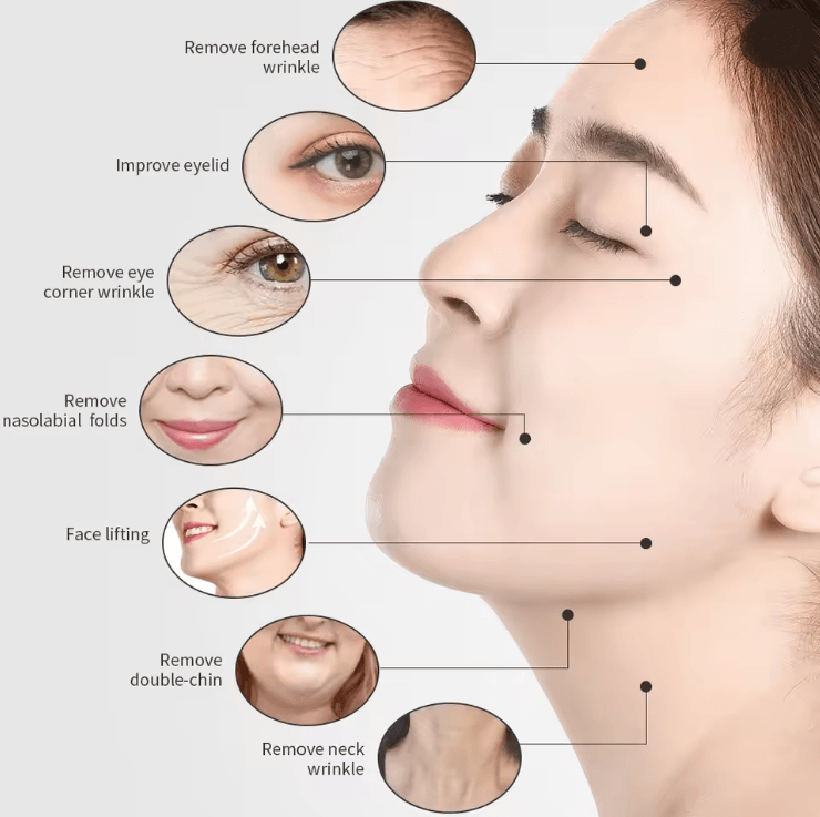 DermaTone 3 In 1 RF Tripolar Facial And Body Lifting Device 1