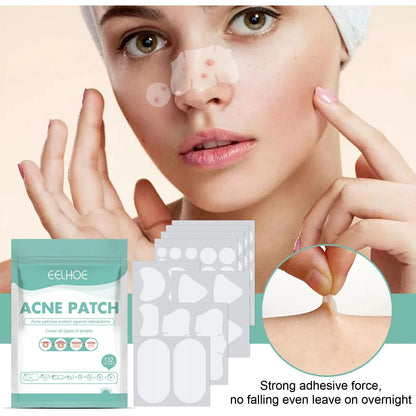 Acne Pimple Patches 132 PCS Hydrocolloid Invisible Skin Care Stickers