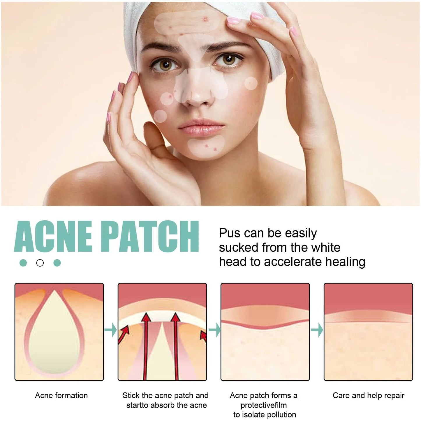 Acne Pimple Patches 132 PCS Hydrocolloid Invisible Skin Care Stickers 2