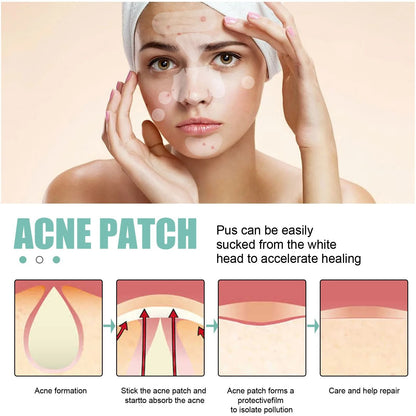 Acne Pimple Patches 132 PCS Hydrocolloid Invisible Skin Care Stickers 2