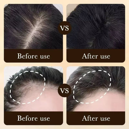 Vita Thick BiotinBoost Hair Growth Oil  Intensive Scalp  Hair Loss Repair Treatment 1