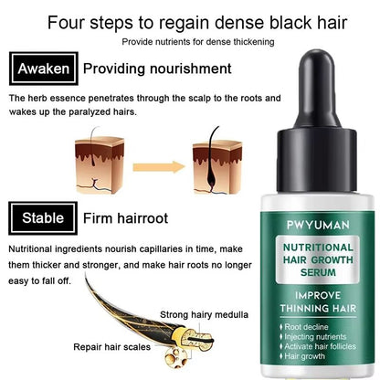 Ginger Germinal Hair Growth Serum  Intensive 7day Root Nourish And Hair Repair Elixir 3
