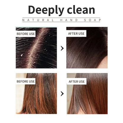 Lavender Oil Control Shampoo  SiliconeFree Refreshing Cleanse For Oily Scalps 1