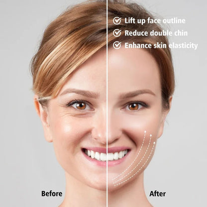 Vibration Face Lift Massager And Double Chin Remover Belt 2