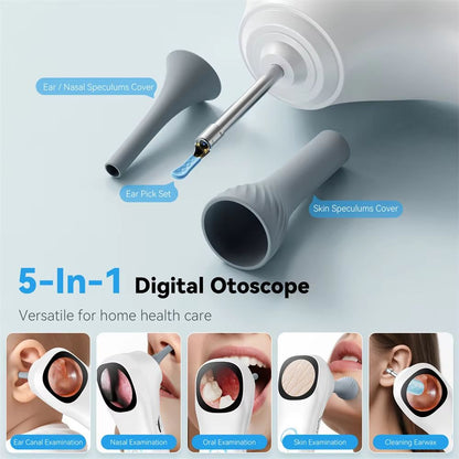 HD Visual Ear Camera Monitor  121inch IPS Screen Smart Otoscope For Ear Nose Mouth Skin  Pets 3