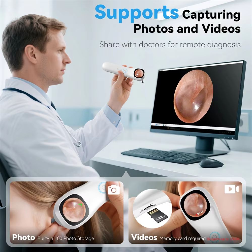 HD Visual Ear Camera Monitor  121inch IPS Screen Smart Otoscope For Ear Nose Mouth Skin  Pets 4