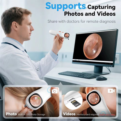 HD Visual Ear Camera Monitor  121inch IPS Screen Smart Otoscope For Ear Nose Mouth Skin  Pets 4