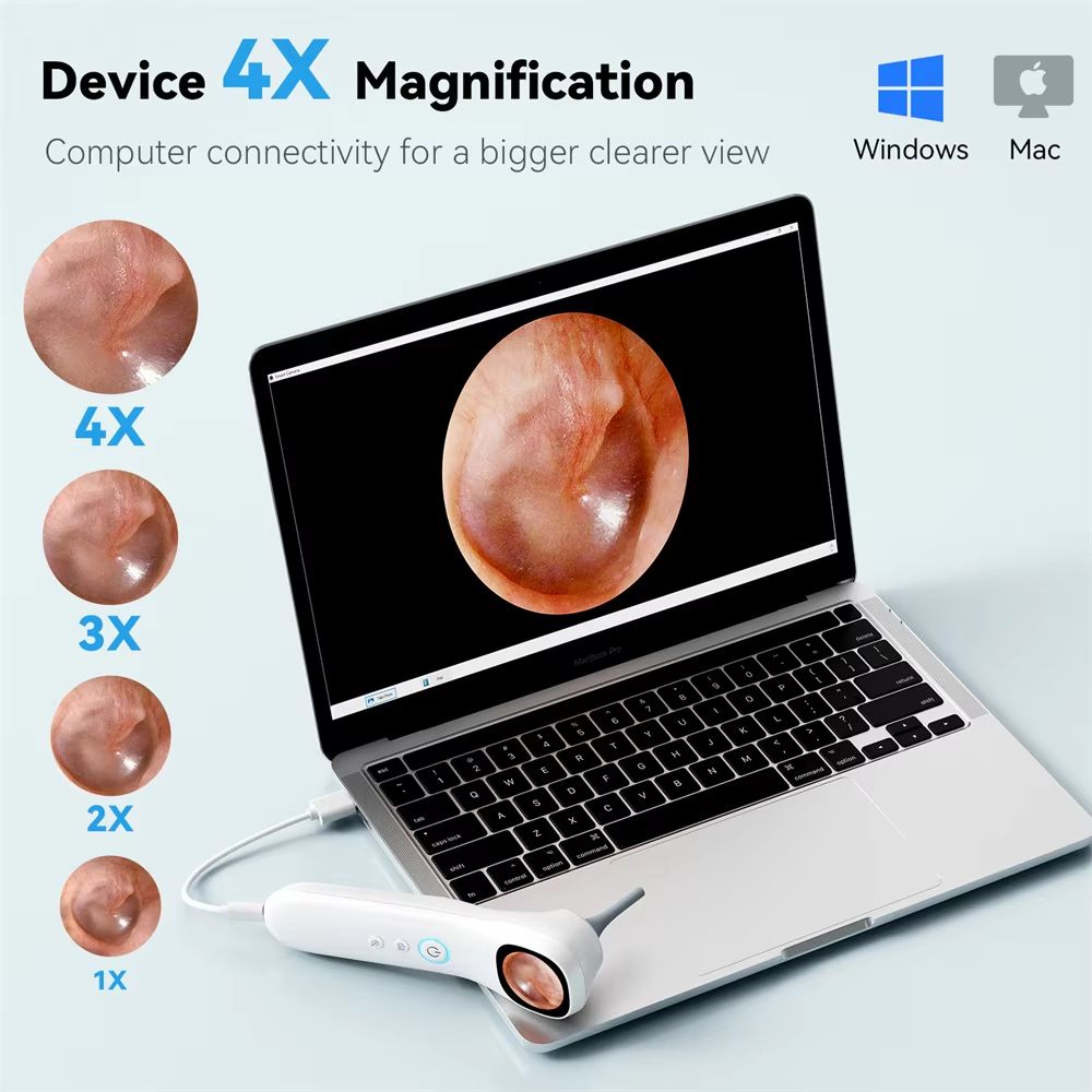 HD Visual Ear Camera Monitor  121inch IPS Screen Smart Otoscope For Ear Nose Mouth Skin  Pets 5