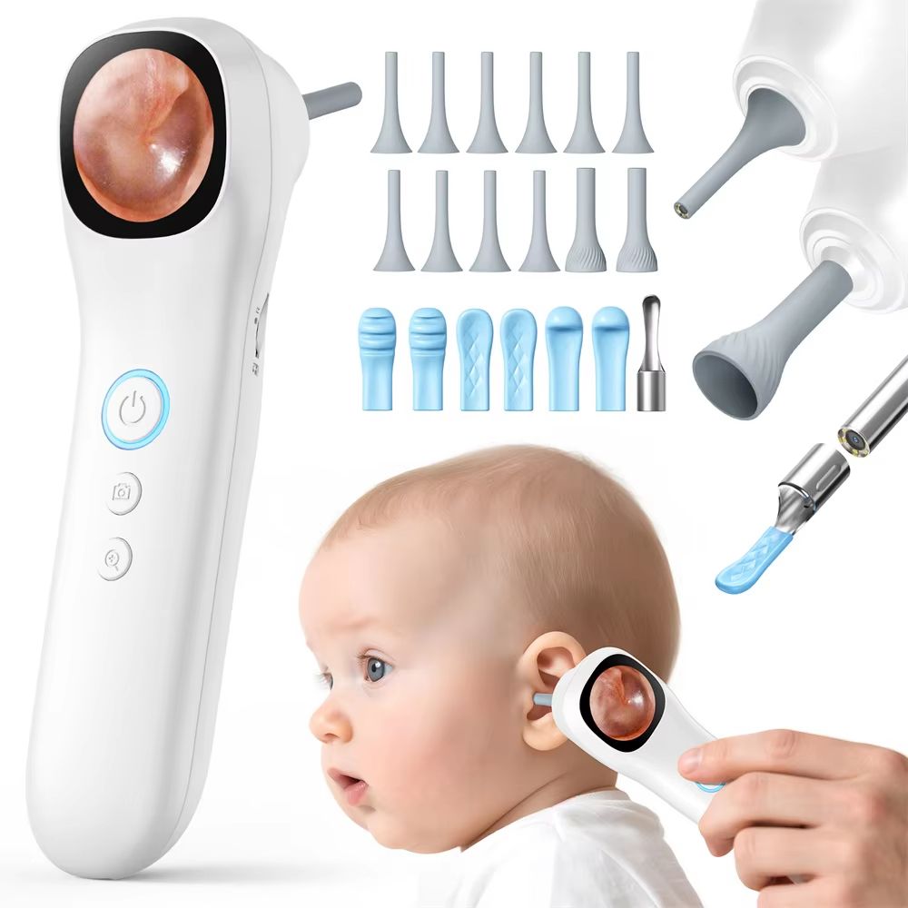 HD Visual Ear Camera Monitor  121inch IPS Screen Smart Otoscope For Ear Nose Mouth Skin  Pets 6