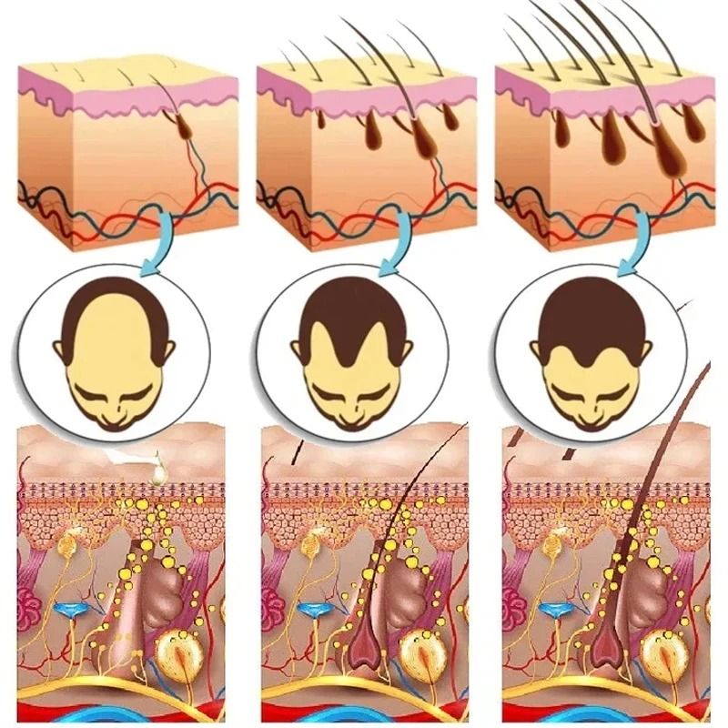7 Days Ginger Hair Growth Serum  FastActing Natural Hair Regrowth Oil For Thicker Fuller Hair And S 3
