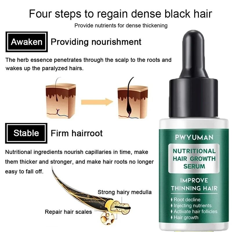 7 Days Ginger Hair Growth Serum  FastActing Natural Hair Regrowth Oil For Thicker Fuller Hair And S 4