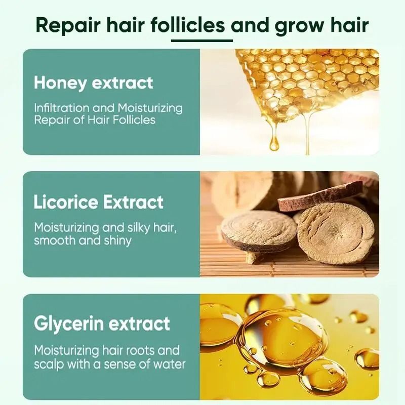 7 Days Ginger Hair Growth Serum  FastActing Natural Hair Regrowth Oil For Thicker Fuller Hair And S 5