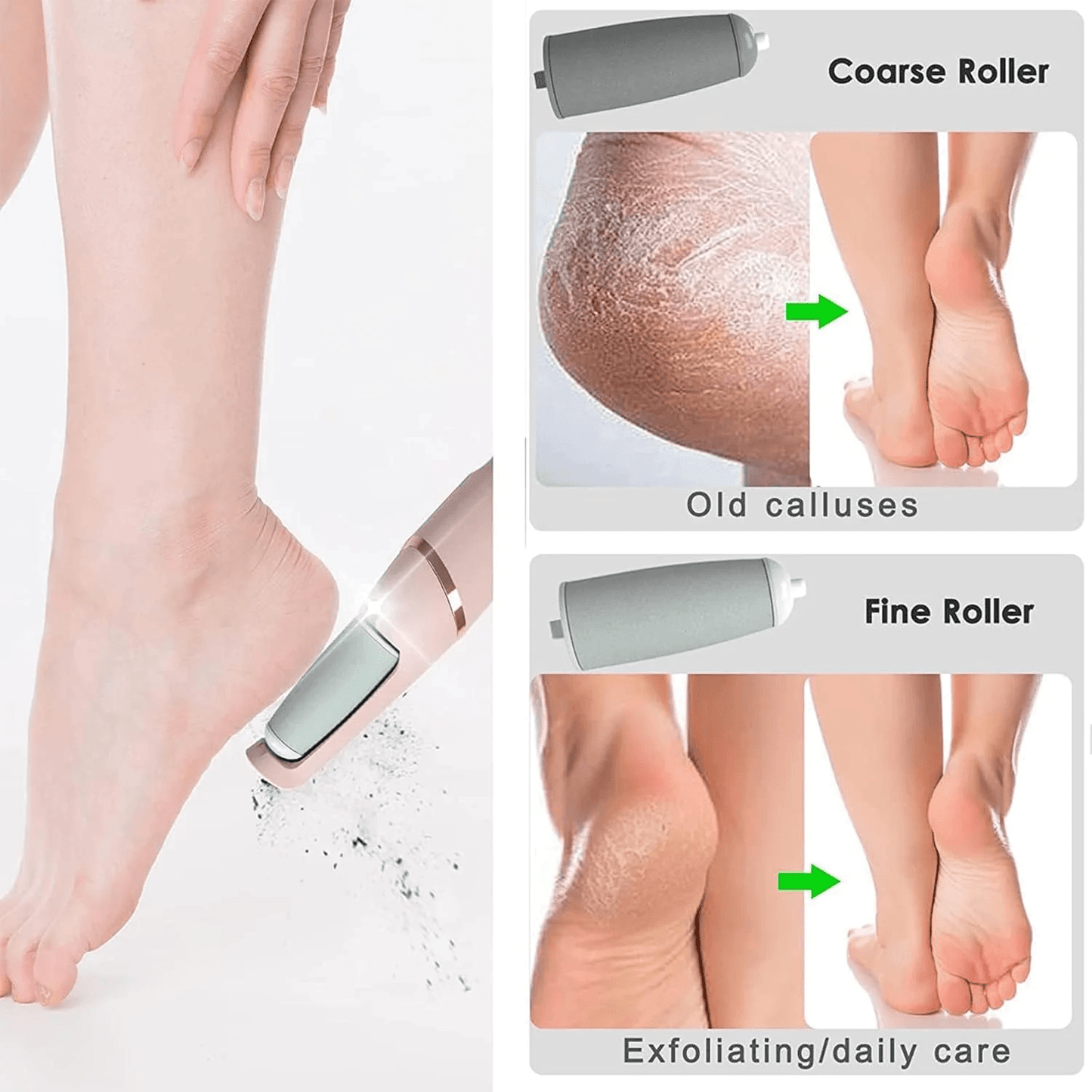 Professional Electric Pedicure Tool Film Foot Dead Skin Callus Remover Feet Exfoliator Pumice Stone 4