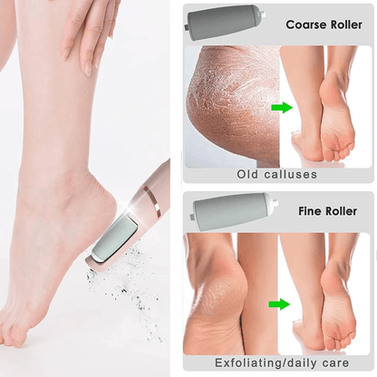 Professional Electric Pedicure Tool Film Foot Dead Skin Callus Remover Feet Exfoliator Pumice Stone 4