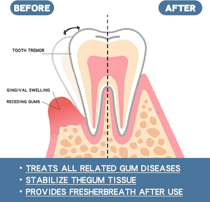 Rapid Repair Gums Serum Instant Relief For Sensitive Teeth Cavities  Gum Damage 2